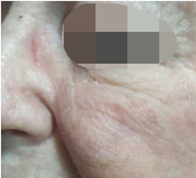 Antes - Ana, 62 años