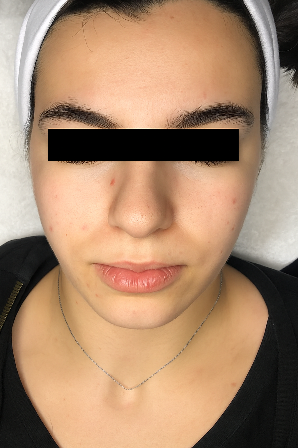 Después - María, 28 años