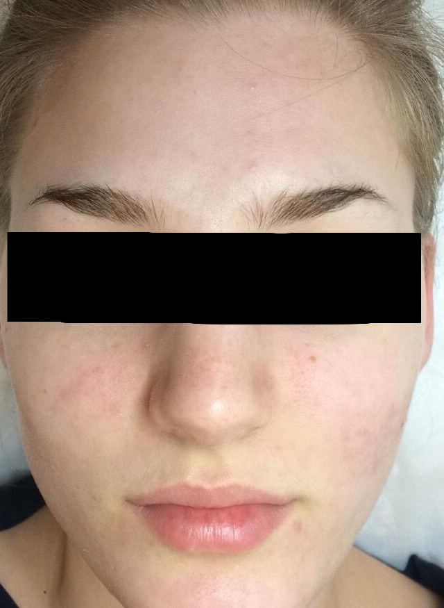 Después - Florencia, 24 años